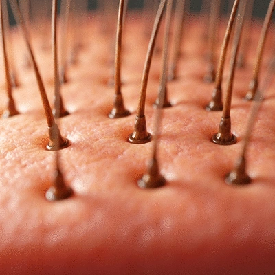 Close-up of healthy hair follicles and scalp, showing regrowth